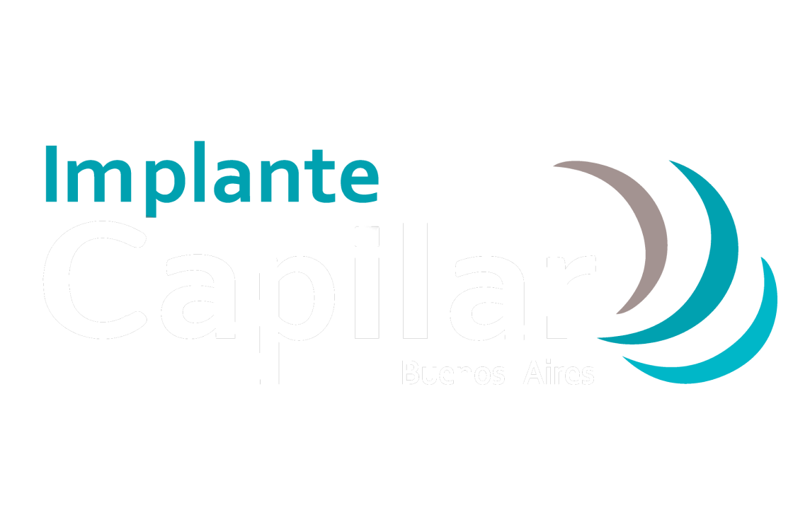 ICBA - Implante Capilar Buenos Aires