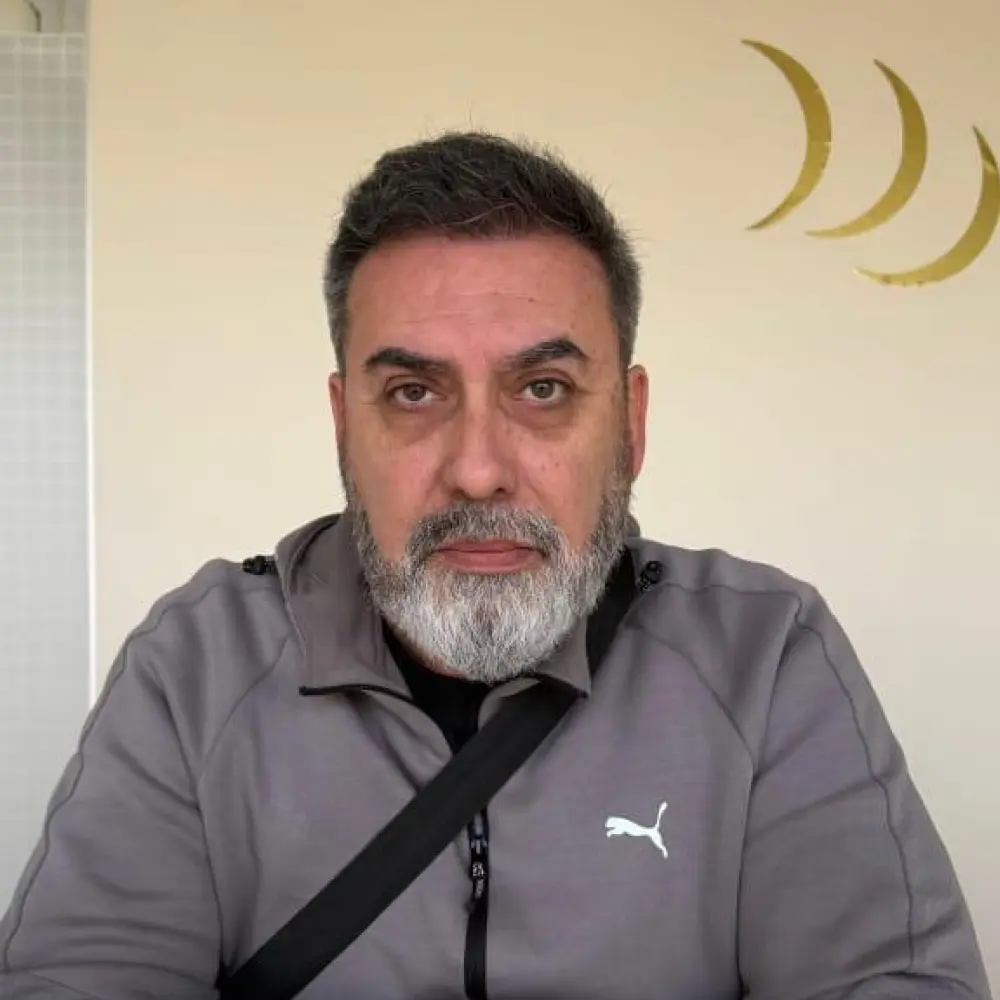 Paciente después del implante capilar