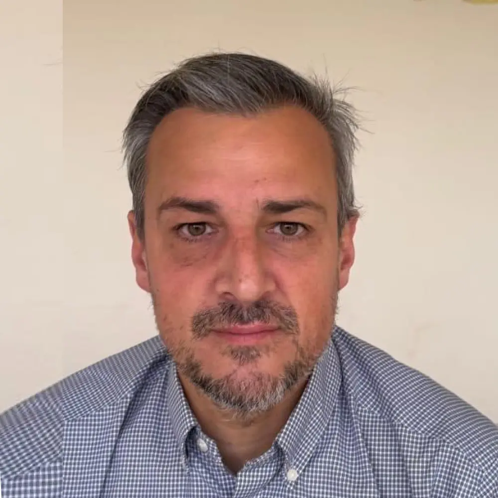 Paciente después del implante capilar