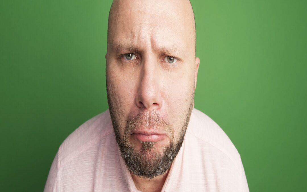 Adulto con alopecia androgénica hombre decepcionado