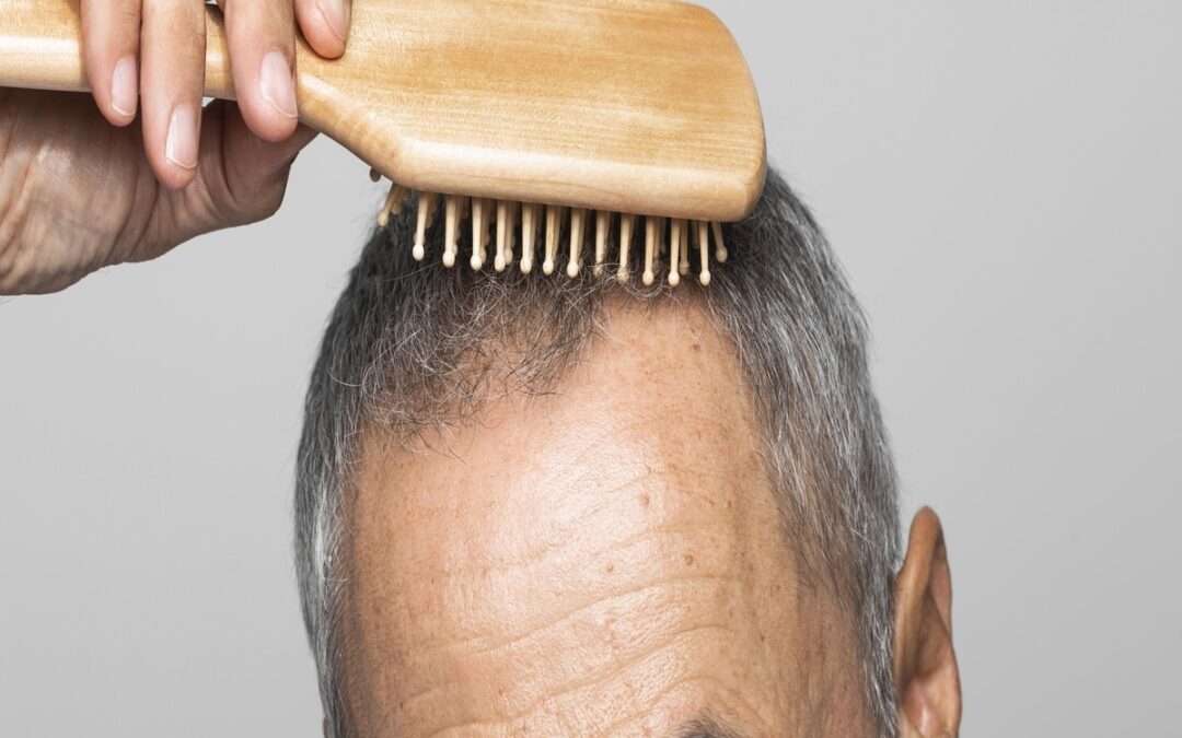 Hombre adulto peinándose la cabeza con el cuero cabelludo lastimado