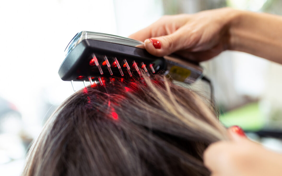 Terapia láser aplicada sobre cabello de mujer