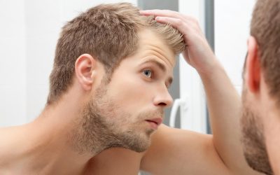 Prevención de la Caída del Cabello en la Adolescencia: Consejos y Soluciones